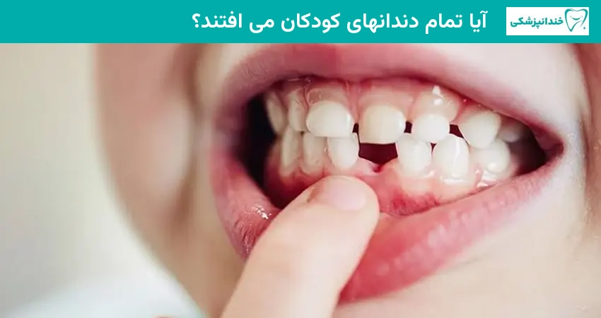 آیا تمام دندانهای کودکان می افتند؟