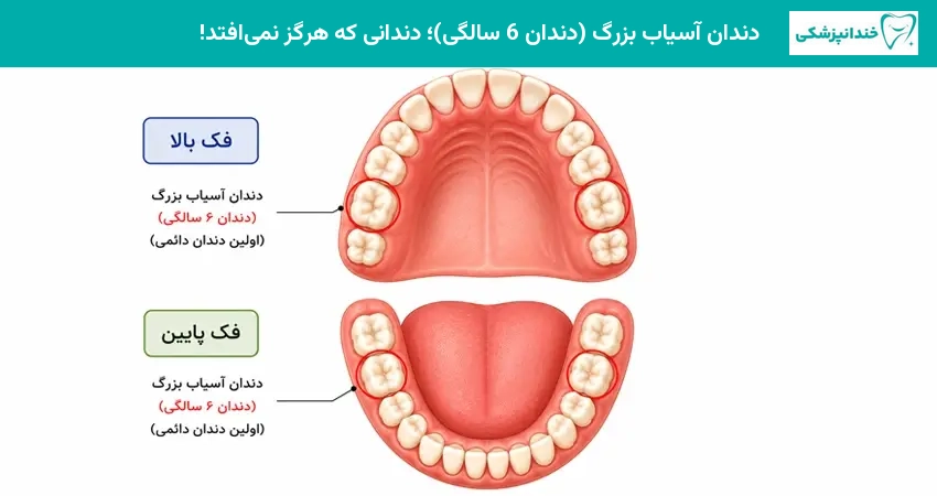 دندان آسیاب بزرگ (دندان 6 سالگی)؛ دندانی که هرگز نمیافتد!