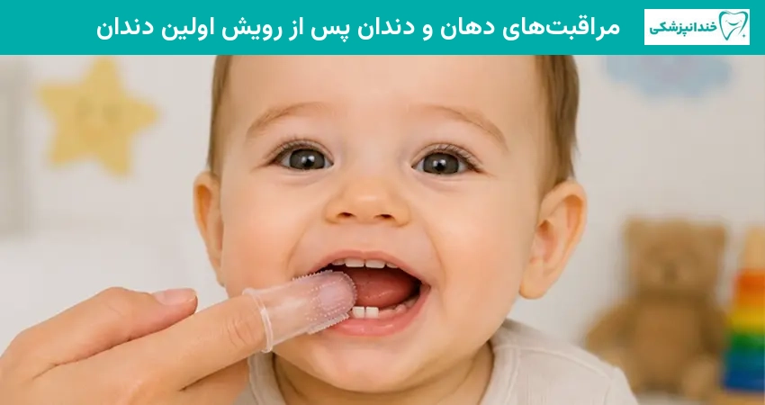 مراقبت های دهان و دندان پس از رویش اولین دندان