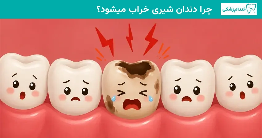 چرا دندان شیری خراب میشود؟