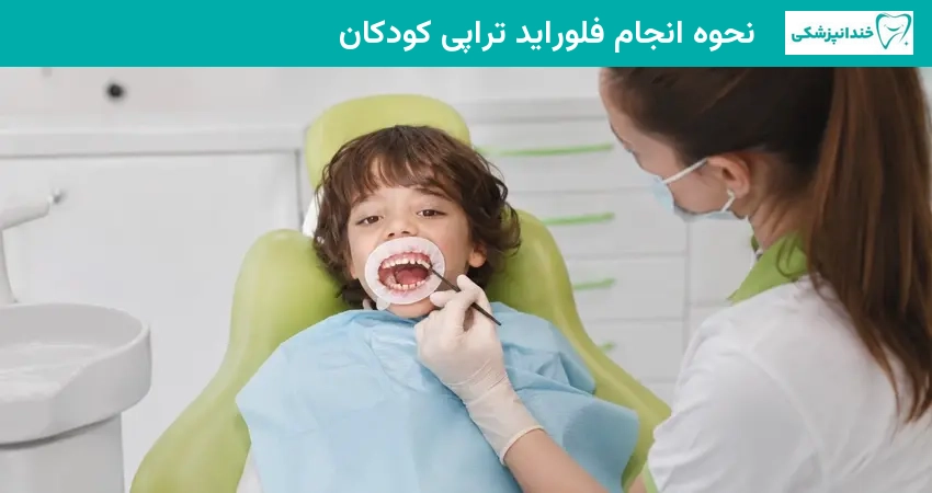 نحوه انجام فلوراید تراپی کودکان