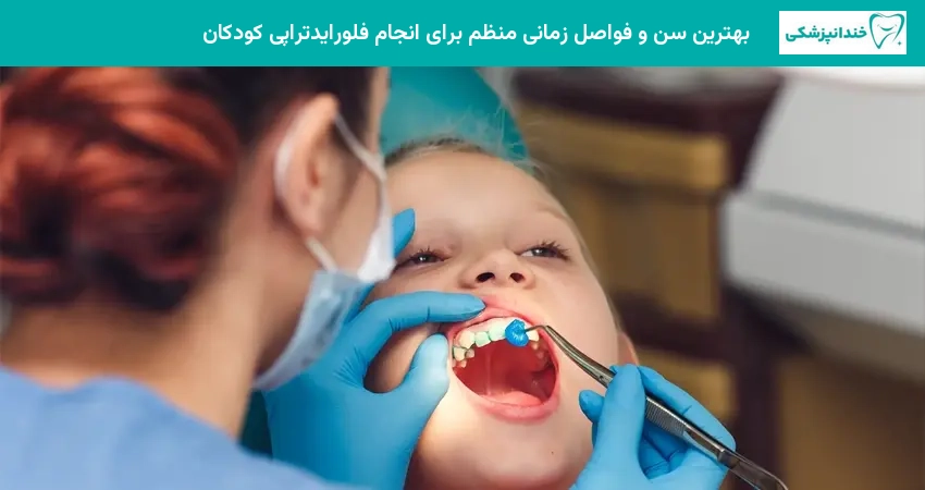 بهترین سن و فواصل زمانی منظم برای انجام فلورایدتراپی کودکان