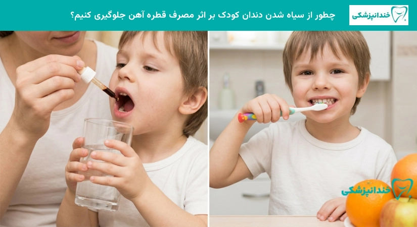 مصرف قطره آهن و ایجاد لکه روی دندان کودک