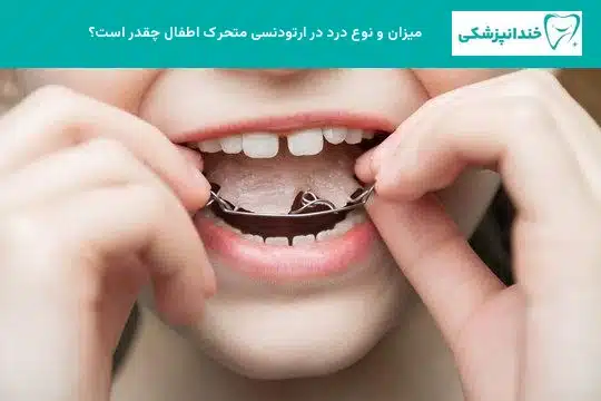 میزان و نوع درد در ارتودنسی متحرک اطفال چقدر است؟