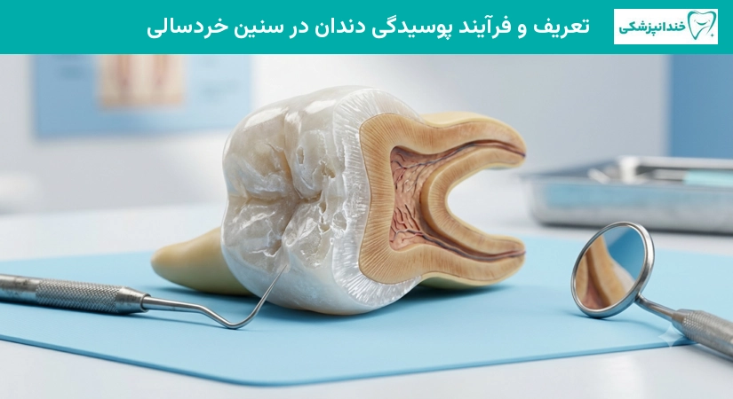 فرایند پوسیدگی دندان در سنین خردسالی