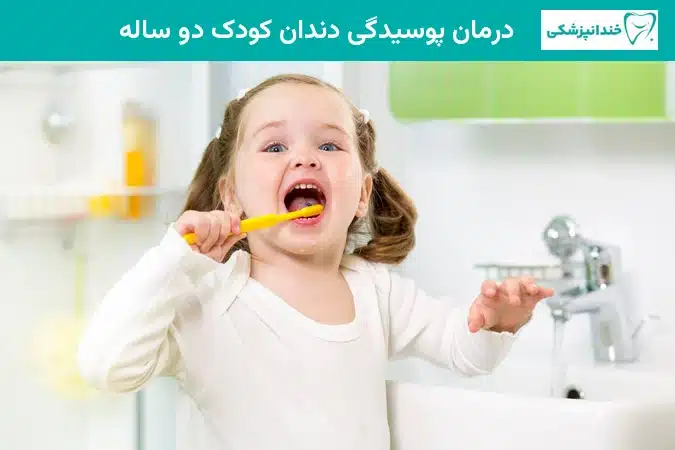 درمان پوسیدگی دندان کودک دو ساله
