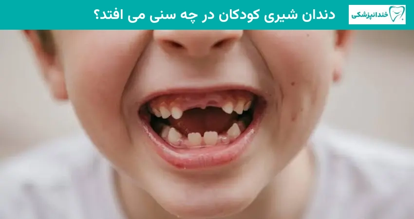 دندان شیری کودکان در چه سنی می افتد؟