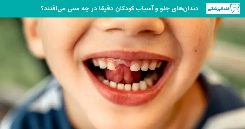 دندانهای جلو و آسیاب کودکان دقیقاً در چه سنی میافتند؟