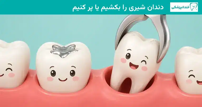 دندان شیری را بکشیم یا پر کنیم