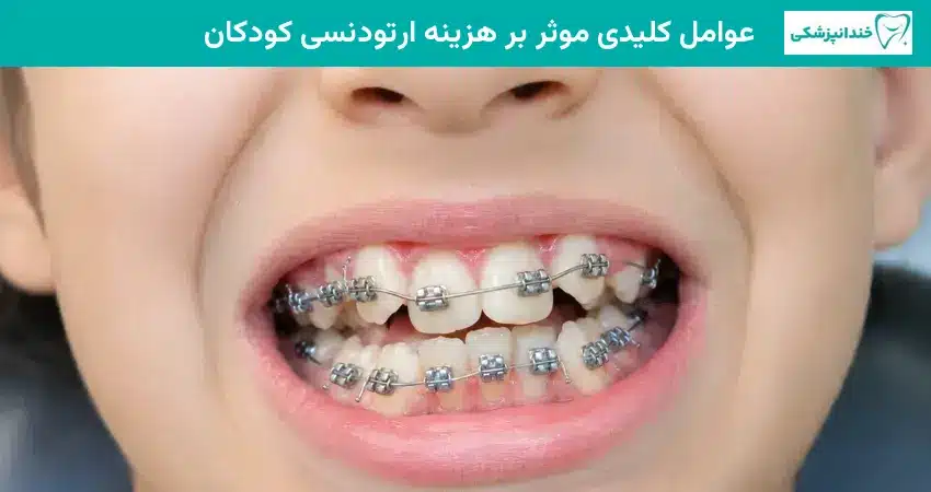 عوامل کلیدی موثر بر هزینه ارتودنسی کودکان