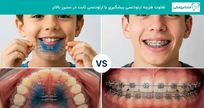 تفاوت هزینه ارتودنسی پیشگیری با ارتودنسی ثابت در سنین بالاتر