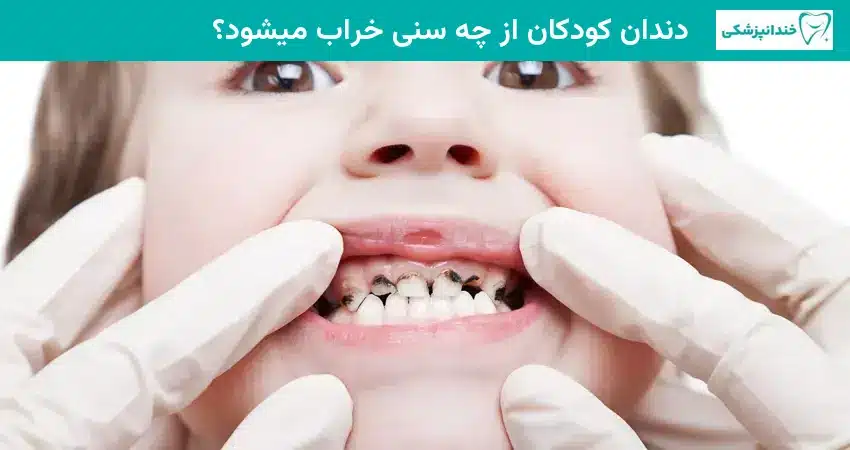 دندان کودکان از چه سنی خراب میشود؟