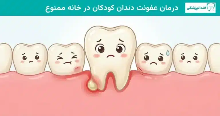درمان عفونت دندان کودکان در خانه ممنوع