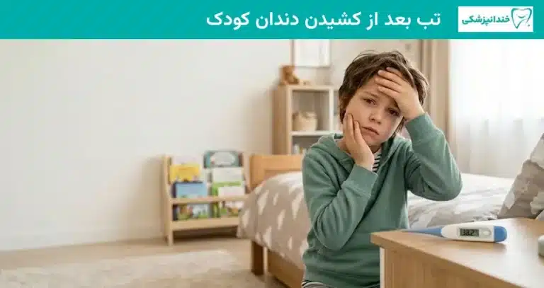 تب بعد از کشیدن دندان کودک