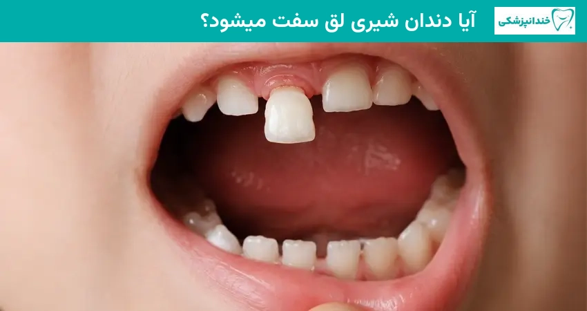 آیا دندان شیری لق سفت میشود؟