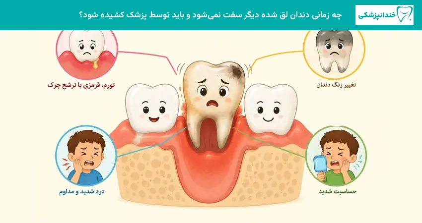 چه زمانی دندان لق شده دیگر سفت نمیشود و باید توسط پزشک کشیده شود؟