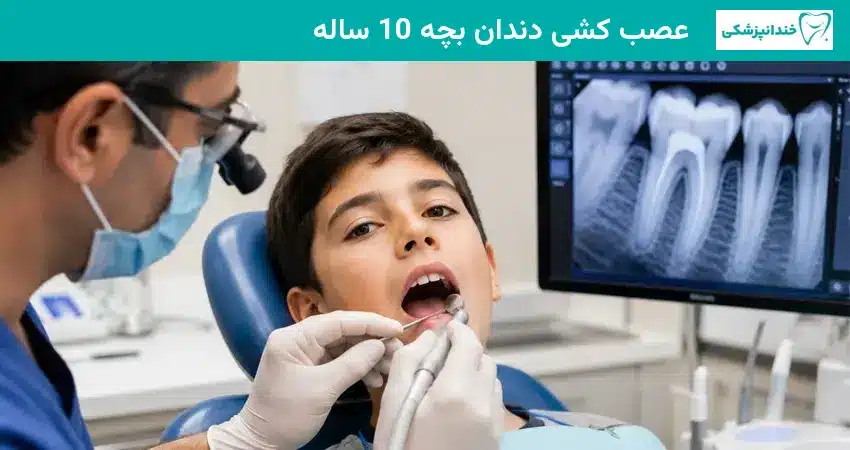 عصب کشی دندان بچه 10 ساله