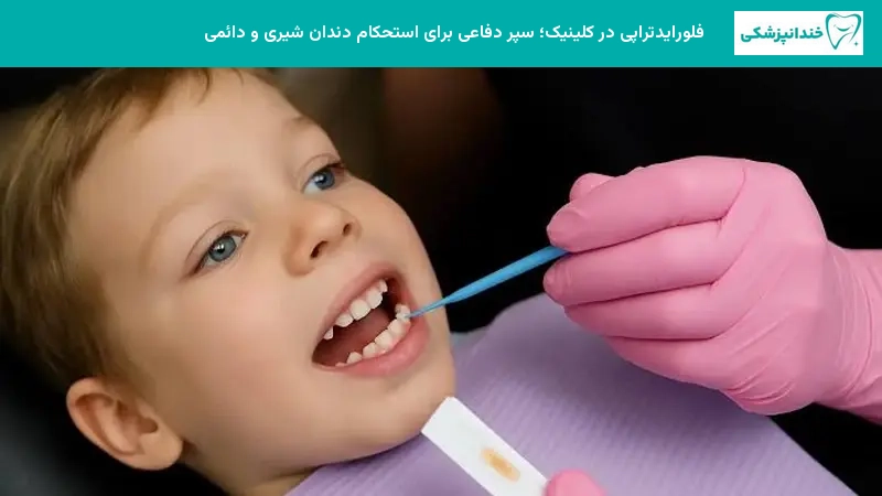 فلورایدتراپی در کلینیک سپر دفاعی برای استحکام دندان شیری و دائمی