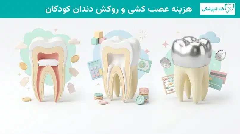 هزینه عصب کشی و روکش دندان کودکان