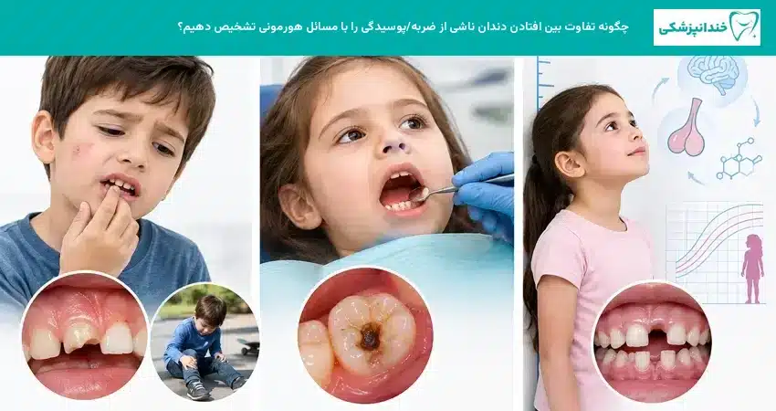 چگونه تفاوت بین افتادن دندان ناشی از ضربه/پوسیدگی را با مسائل هورمونی تشخیص دهیم؟