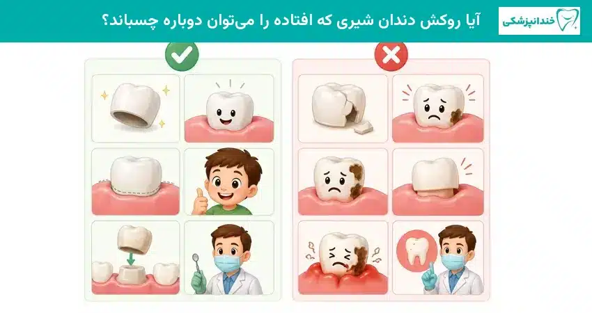 آیا روکش دندان شیری که افتاده را میتوان دوباره چسباند؟