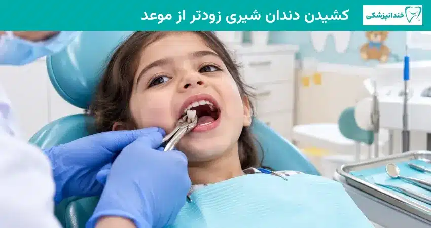 کشیدن دندان شیری زودتر از موعد