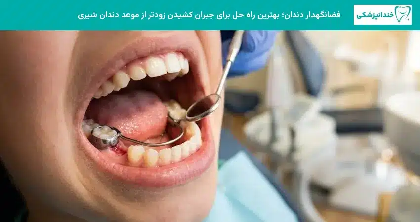 فضانگهدار دندان؛ بهترین راه حل برای جبران کشیدن زودتر از موعد دندان شیری