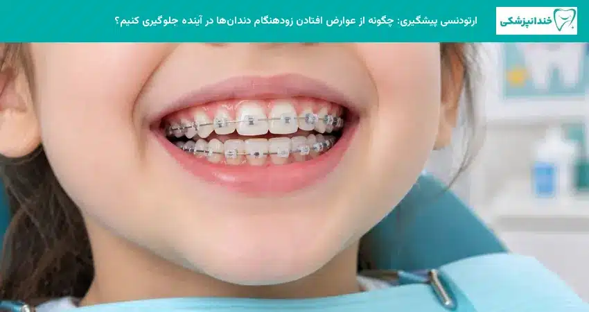 ارتودنسی پیشگیری: چگونه از عوارض افتادن زودهنگام دندانها در آینده جلوگیری کنیم؟