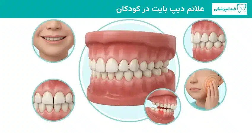 علائم دیپ بایت در کودکان
