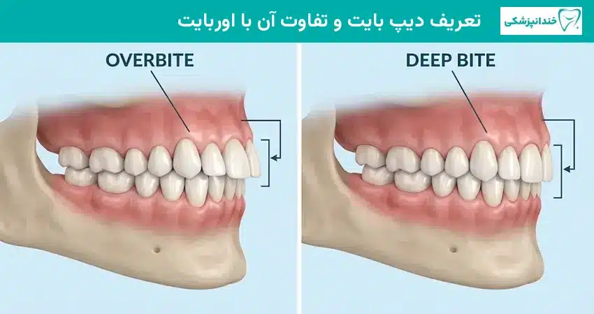 تعریف دیپ بایت و تفاوت آن با اوربایت