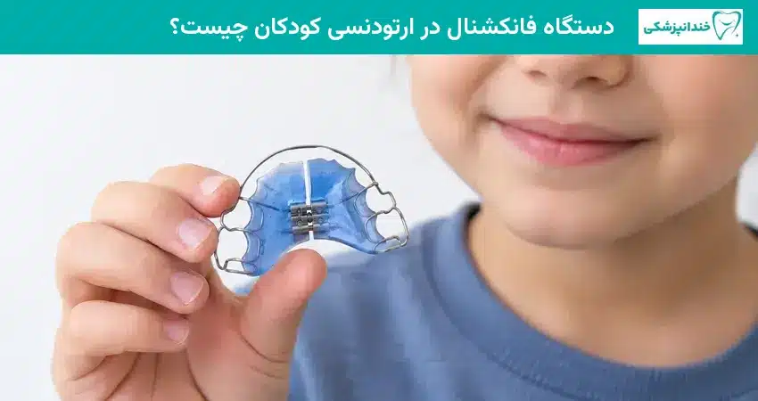 دستگاه فانکشنال در ارتودنسی کودکان چیست؟