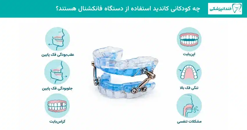 چه کودکانی کاندید استفاده از دستگاه فانکشنال هستند؟