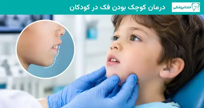 درمان کوچک بودن فک در کودکان