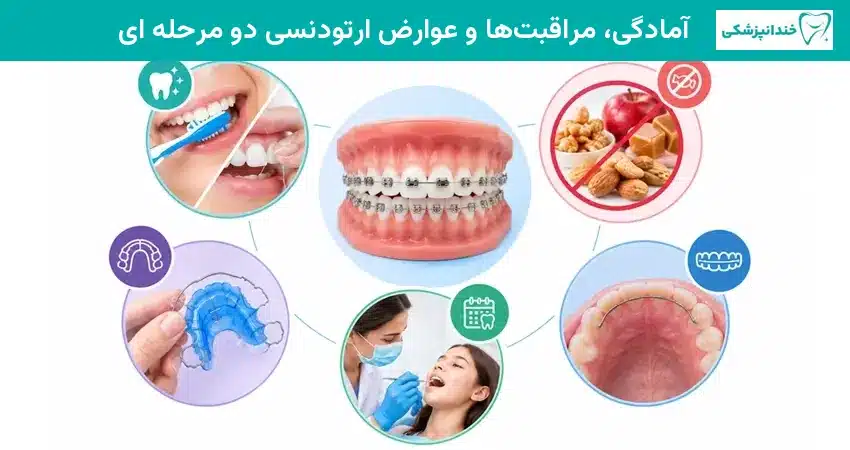 آمادگی، مراقبتها و عوارض ارتودنسی دو مرحله ای