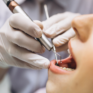dental-1